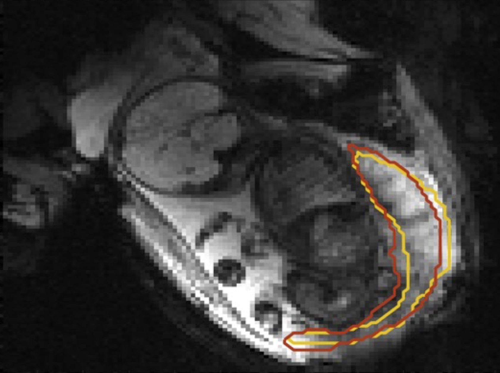Shape-aware Segmentation of the Placenta in BOLD Fetal MRI Time Series