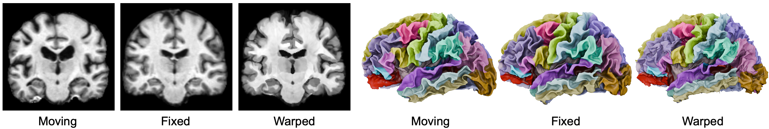 Unified Brain Surface and Volume Registration